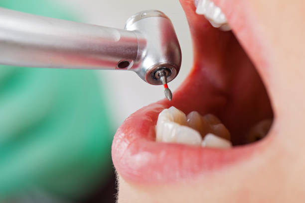 Best Emergency Dental Surgery in Oak Ridge, NC